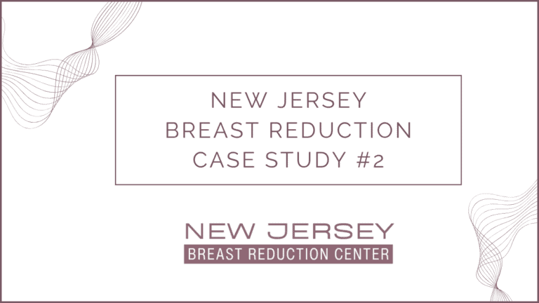 NJ Breast Reduction Case Study 2