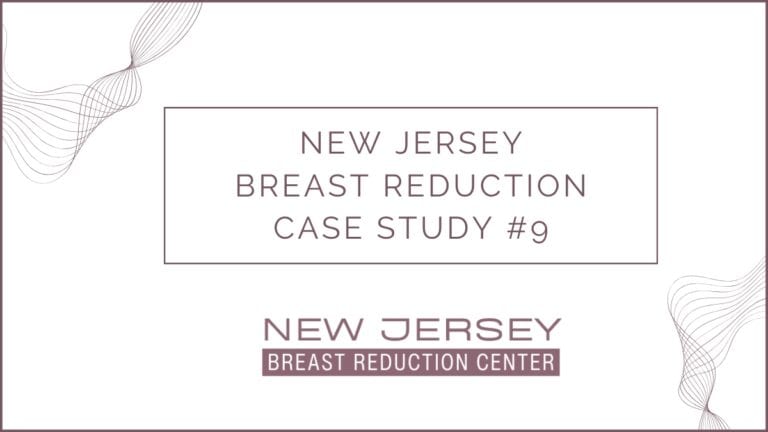 Case Study: How Excess Skin Buildup Shapes the Need for a Reduction